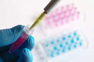 痛心！《柳叶刀》 一年新增30万年轻癌症病人，4种癌夺走他们的生命